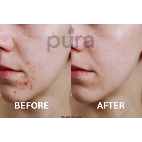 Púra Faucet Filter